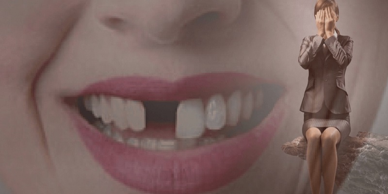 Những điều bí ẩn đằng sau giấc mơ rụng răng